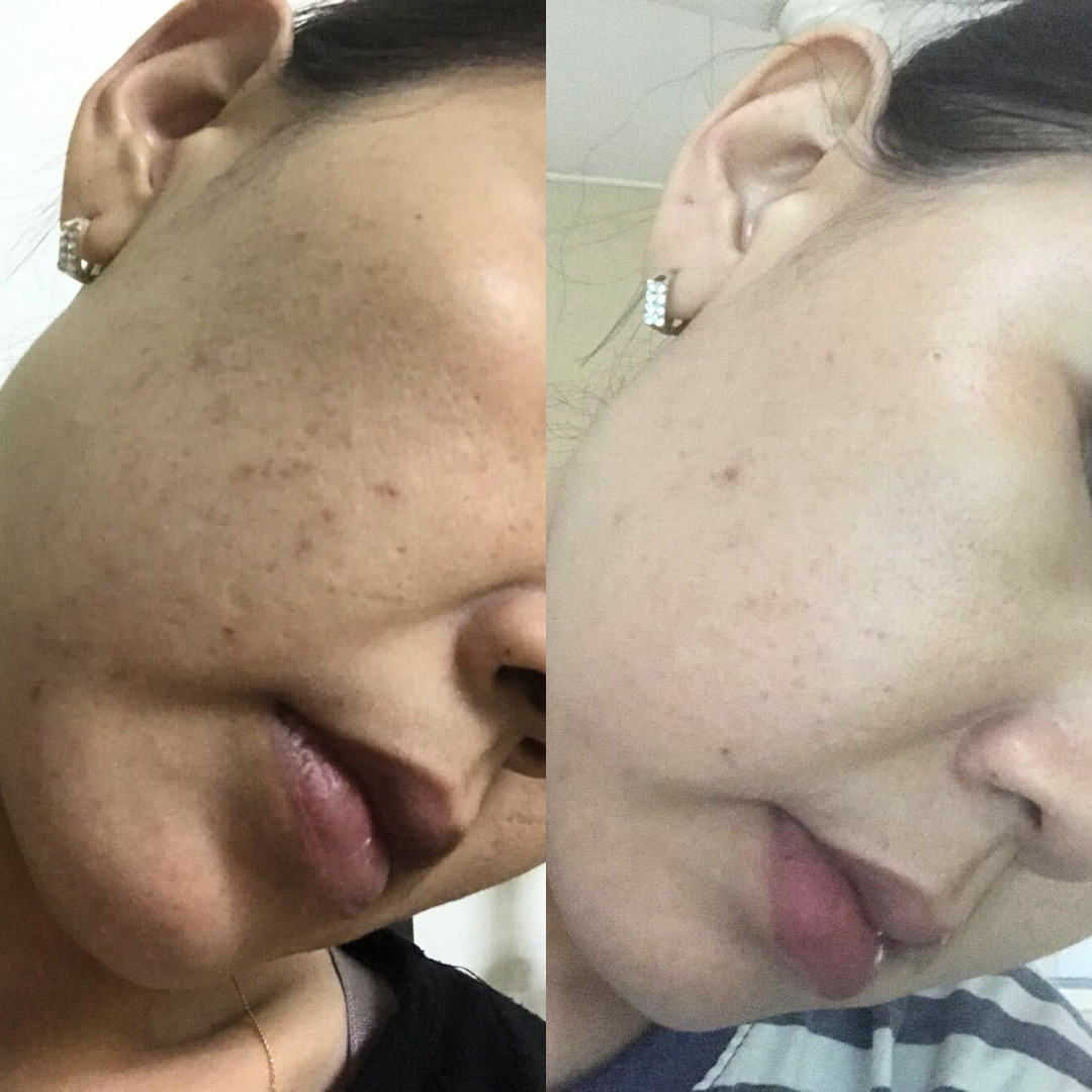 升级版保湿清爽洁面胶 (100ML)