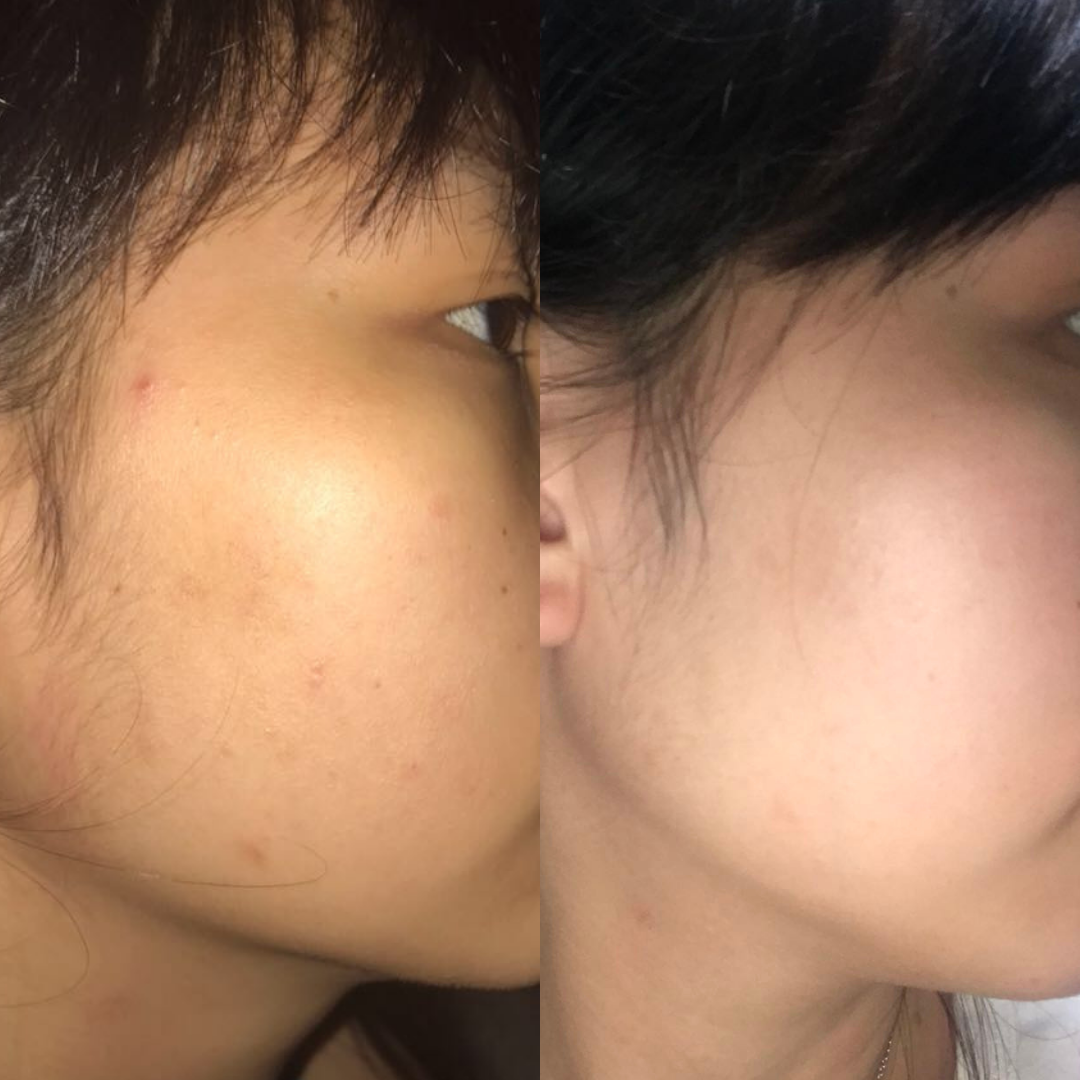 全方位保养旅行套组