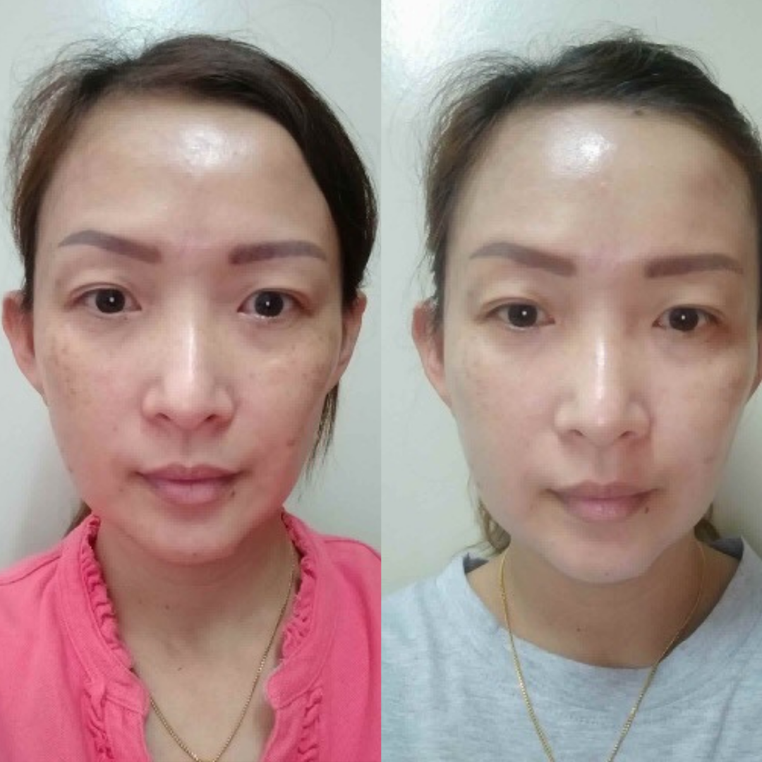 Coconut GLOW Trial Set [ Cleanser , Toner , Serum ]
